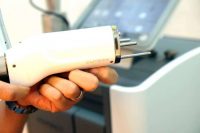 máy xóa xăm laser pico