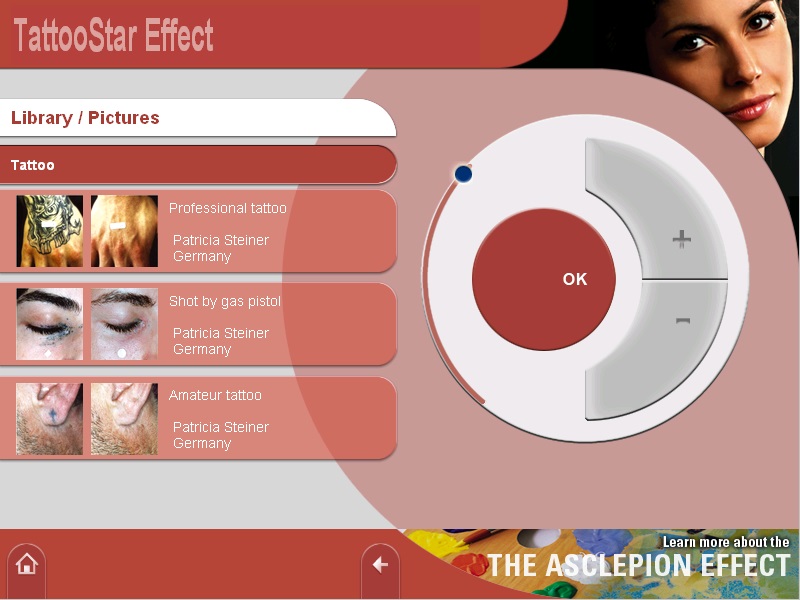 máy tri nám xung vuông tattoostar