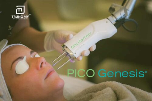 Công nghệ laser pico