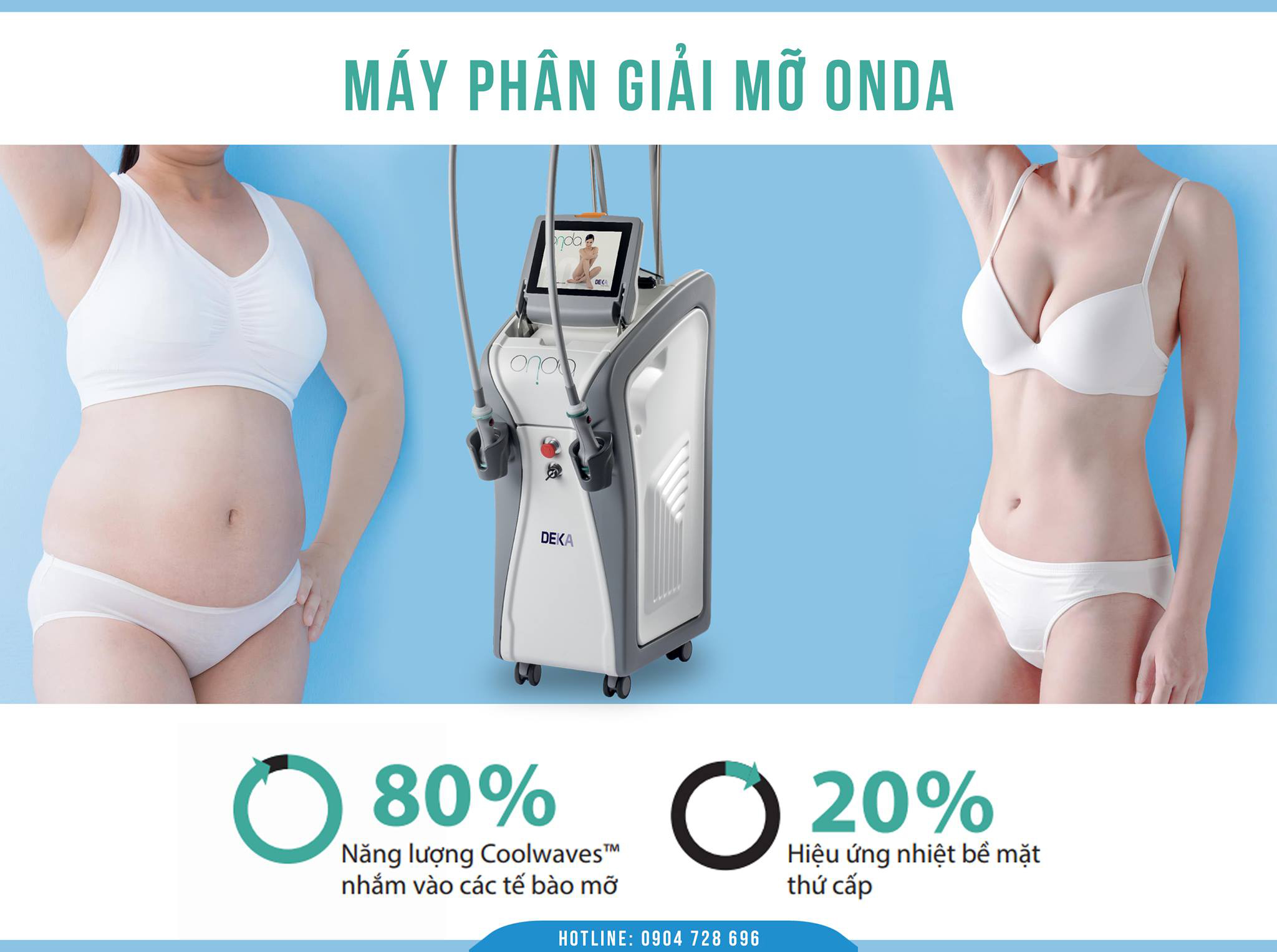 giam-beo-vi-song-onda