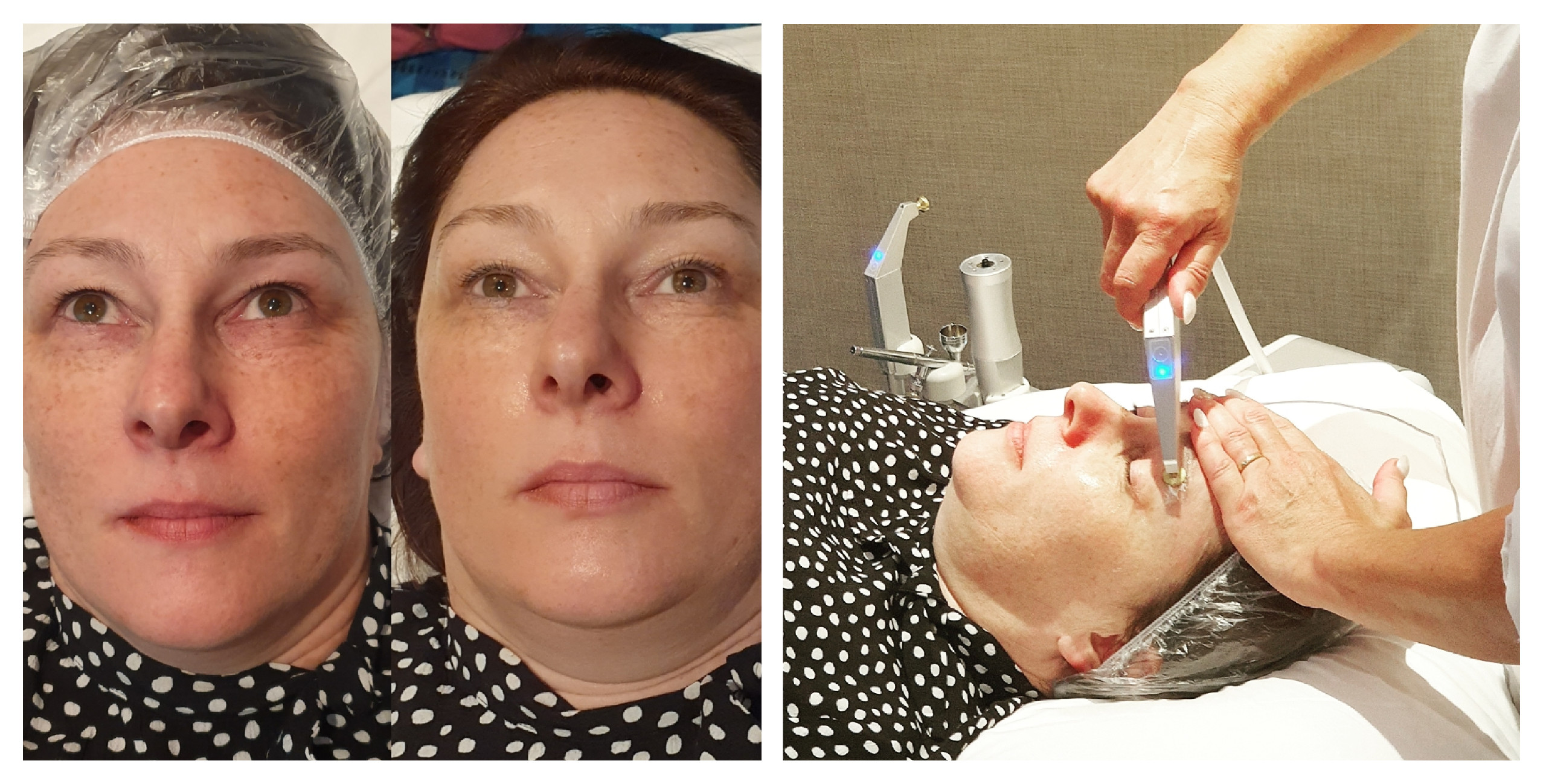 oxyjet-leo-hieu-qua-vuot-troi